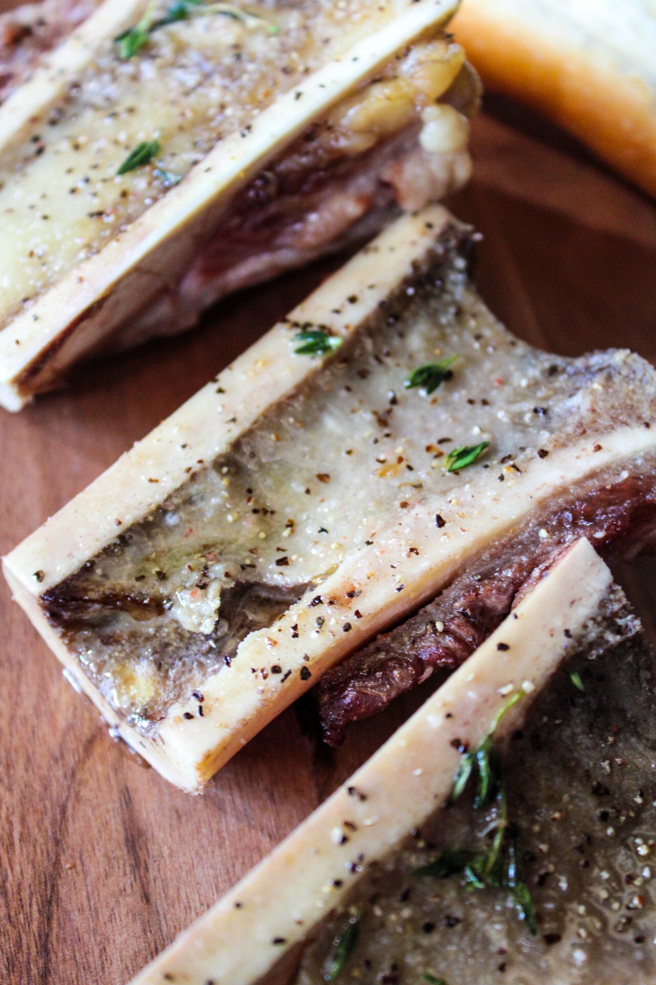 Bone Marrow